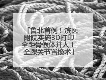 鲁北首例！滨医附院实施3D打印全距骨假体并人工全踝关节置换术